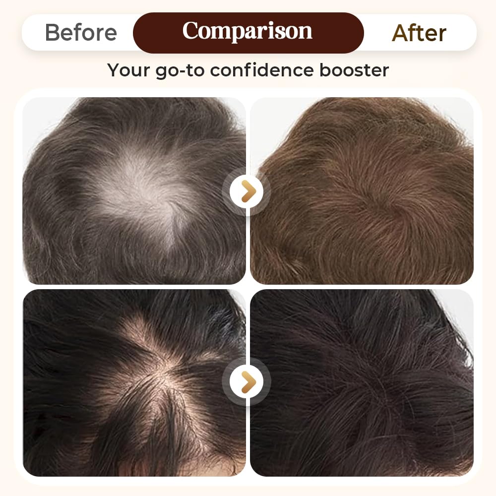 Hair Density Filler - 24-Hour Stain-Proof Hairline Powder for Bald Spot Concealing | Auburn Color