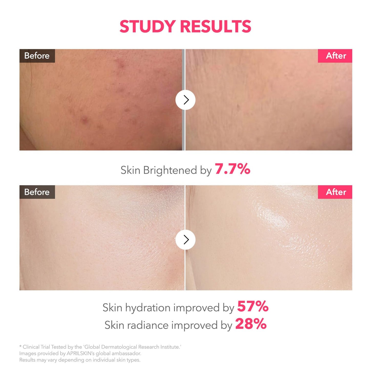 APRILSKIN TXA Pink Capsule Gel Mask - Overnight Face Mask for Glass Glow Skin | 99% Tranexamic Acid, Hydrating & Firming | 30g x 4ea