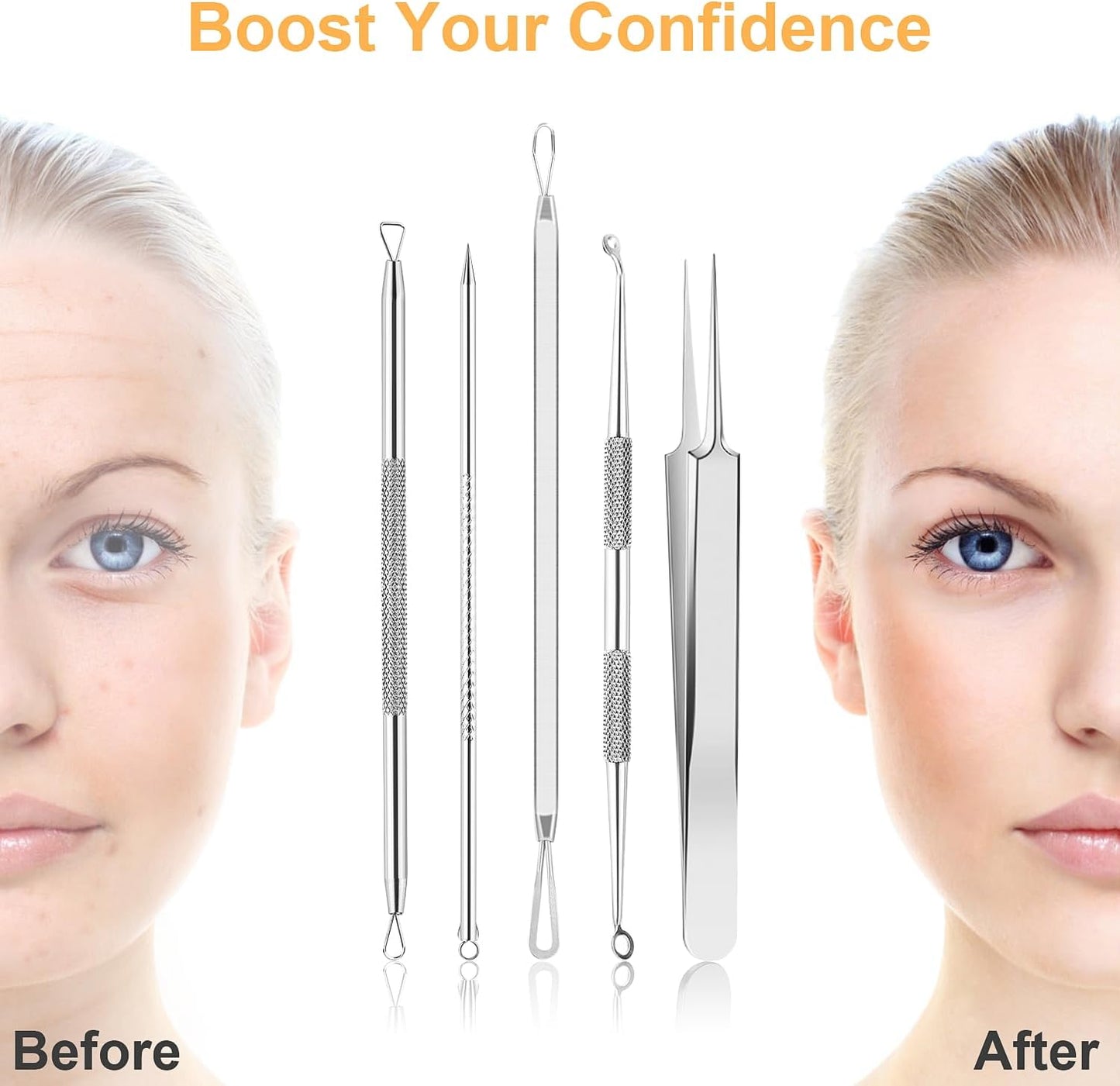 UUBAAR Blackhead Remover Tools Kit - 9PCS Stainless Steel Acne Extractors & Tweezers | Precision Face & Nose Care Set