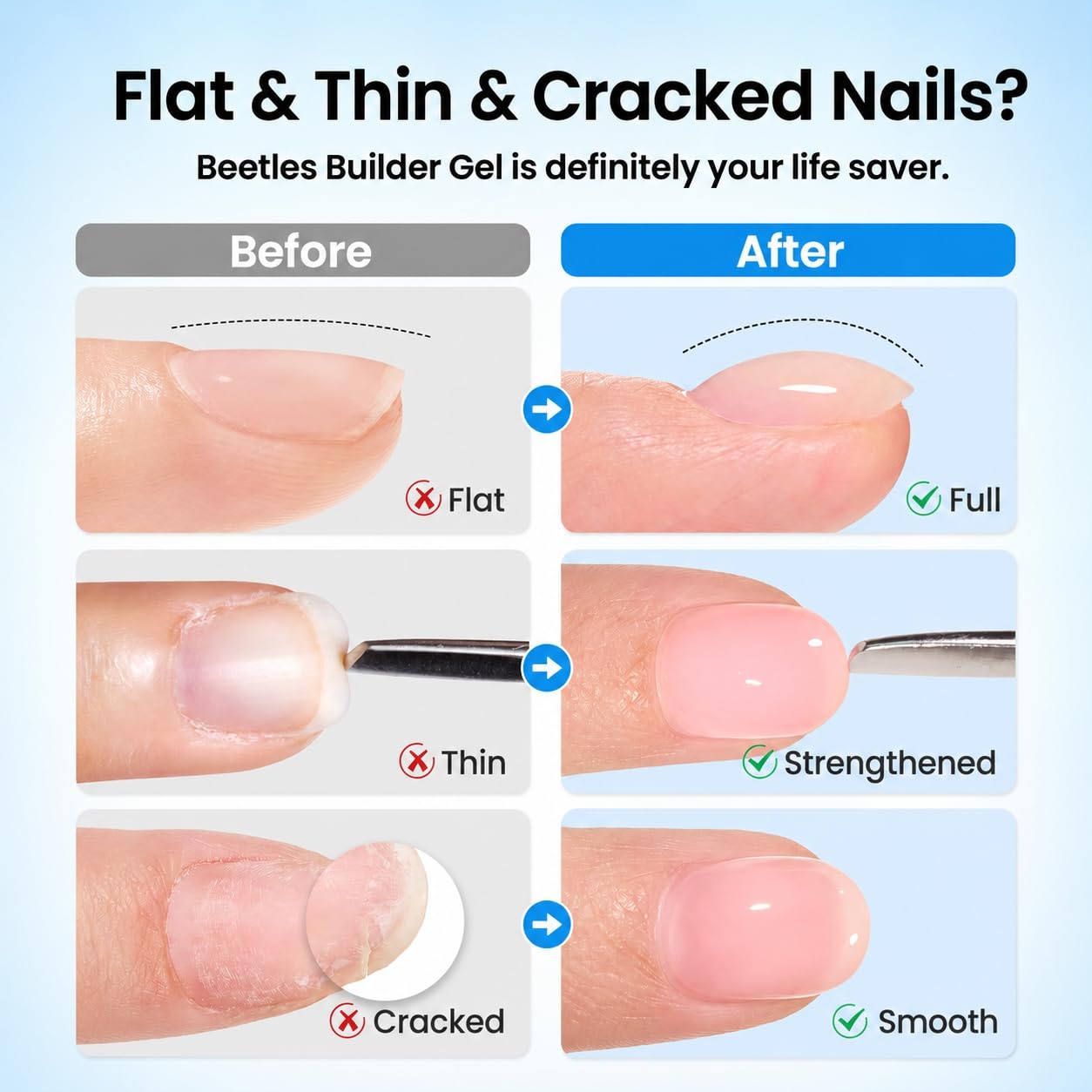 Beetles 3Pcs 15ml Builder Nail Gel with No Wipe Top Coat and Base Coat Kit for Gel Polish Shine Finish & Long Lasting Nail Protection UV/LED Lamp Needed Gift for Women