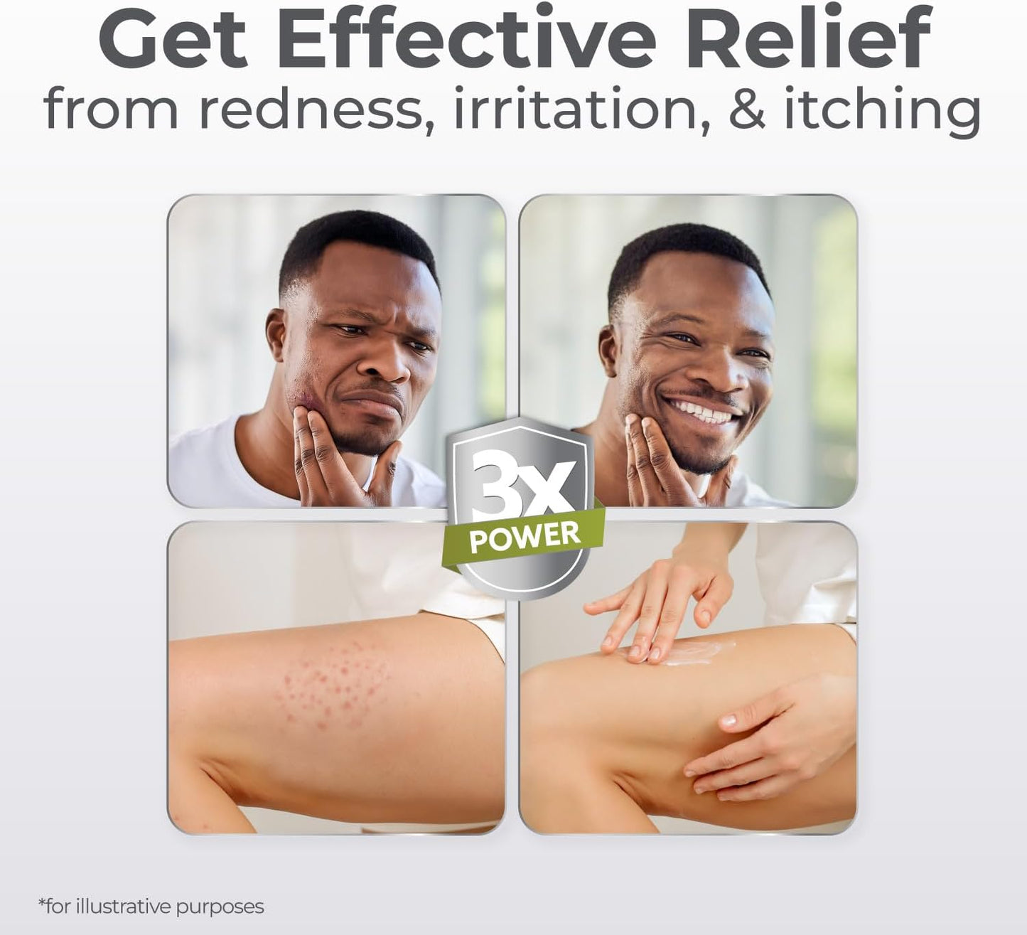 Folliculitis Treatment Cream - 1% Clotrimazole for Ingrown Hair & Itching | Natural Ingredients, 1.7 oz