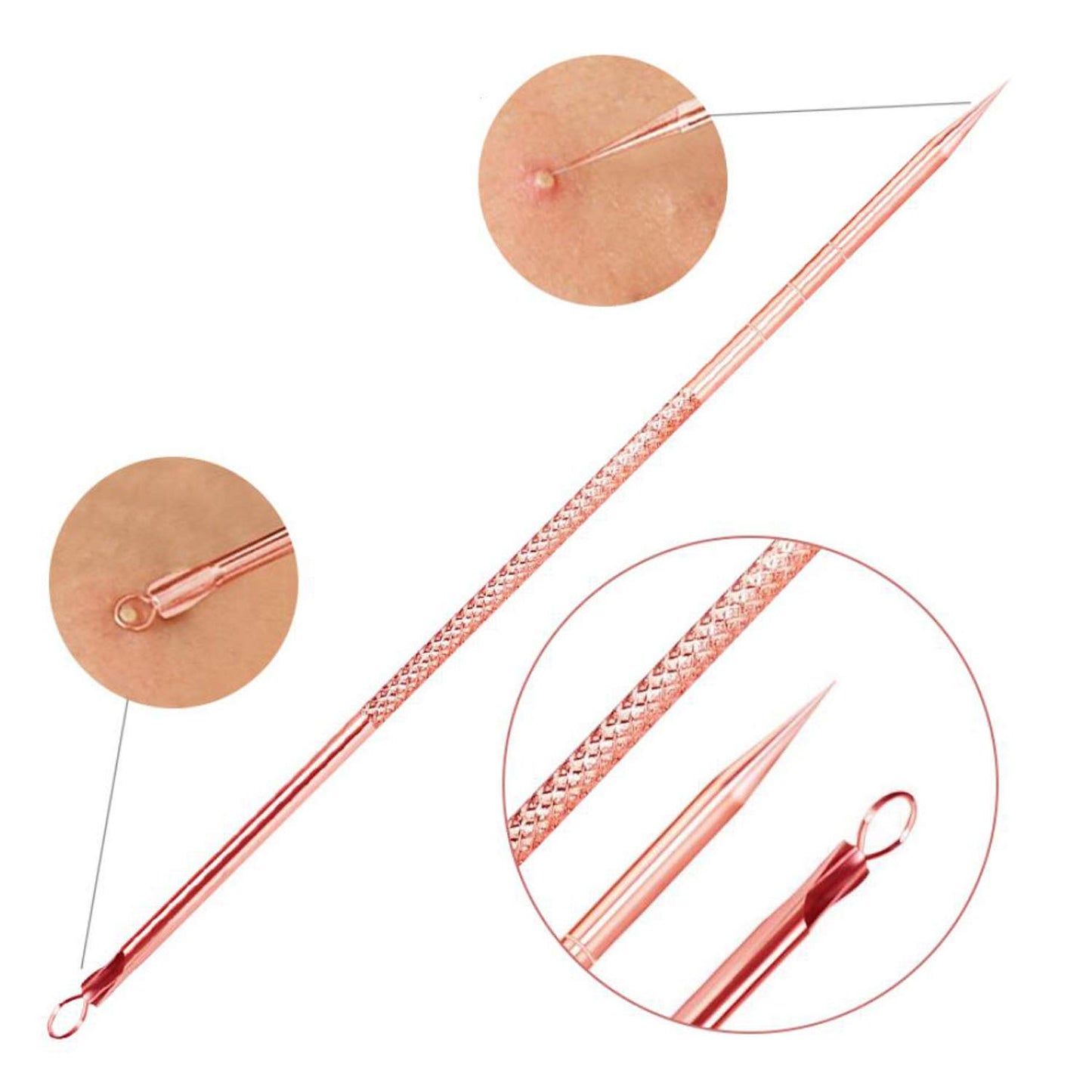 Blackhead Remover Tool - Comedone Extractor Kit for Acne Treatment | Blemish & Whitehead Removal, Includes Case (Rose)