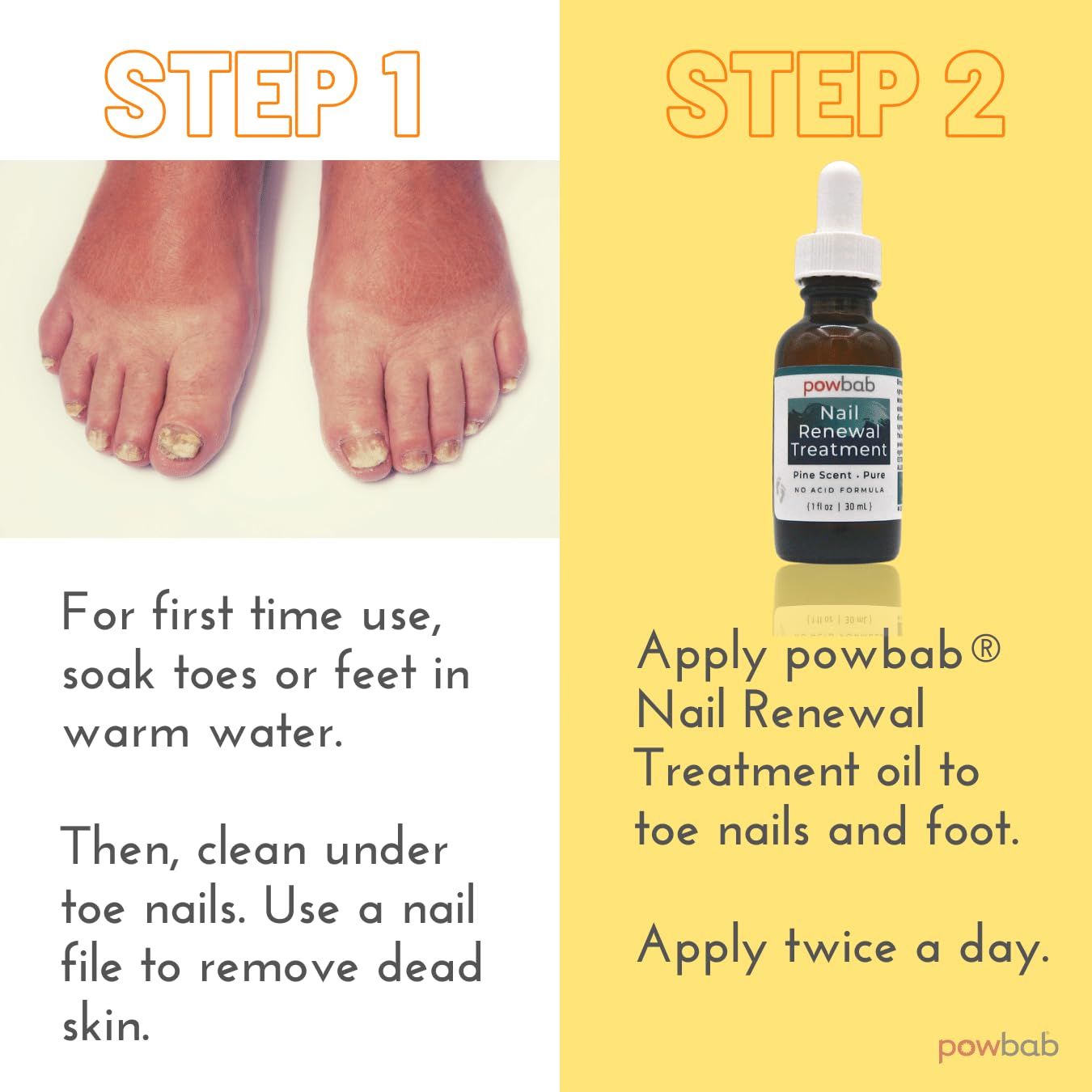 powbab Nail Renewal Treatment for Toenail. Pine Needle Scent, No Acid Formula. 100% Natural Solution Toenail Treatment Extra Strength for Foot and Nail. Natural Toe Nail Treatment - 1 oz