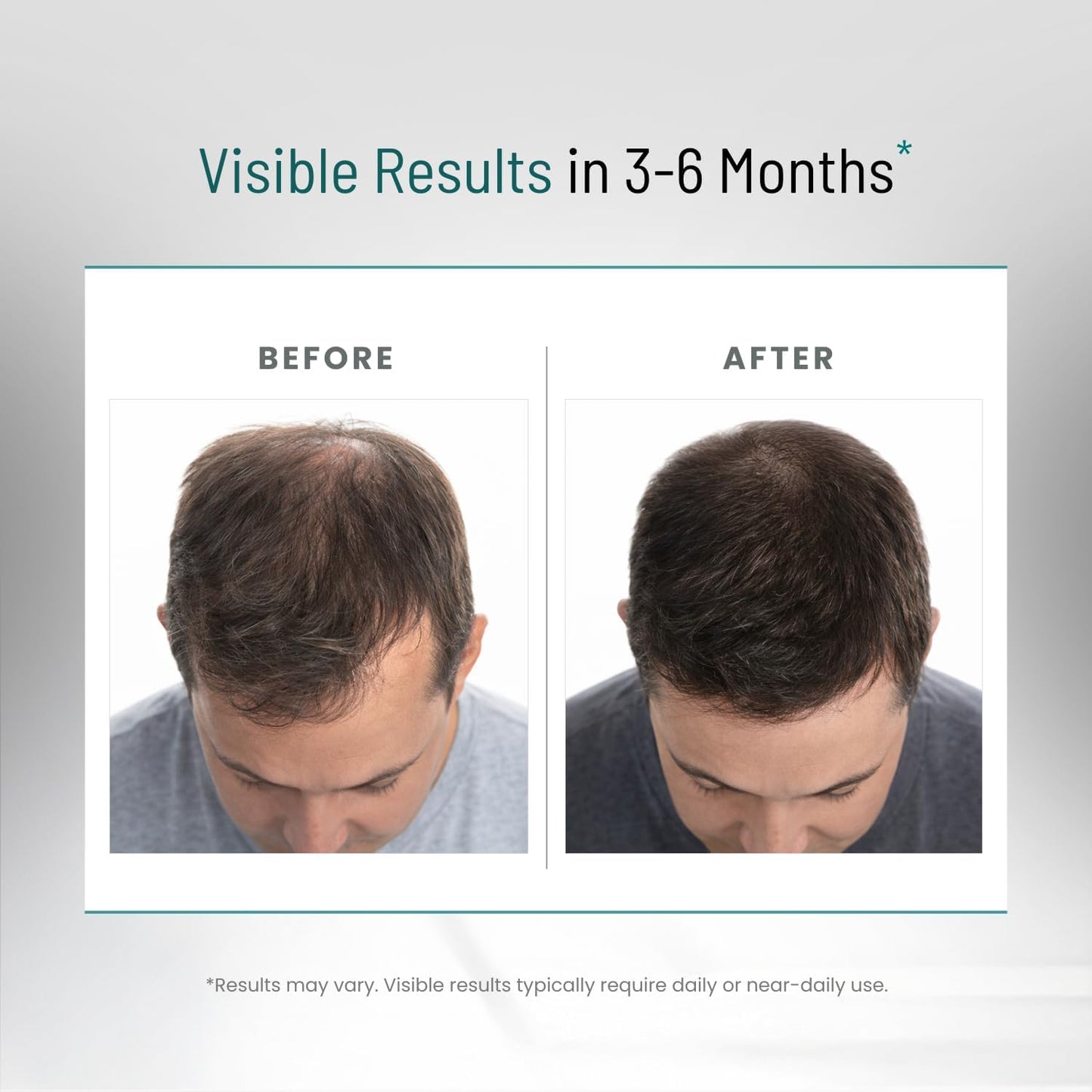 DHT Blocker for Men - Ultra Potent Hair Growth Formula with Saw Palmetto & Biotin | 90 Natural Hair Loss Supplements