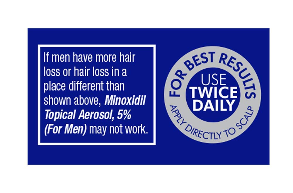 Minoxidil for Men, 2.11 Oz (1 Month Supply) Clinically Proven to Regrow Hair, Topical Aerosol Foam 5%, Hair Thinning Treatment