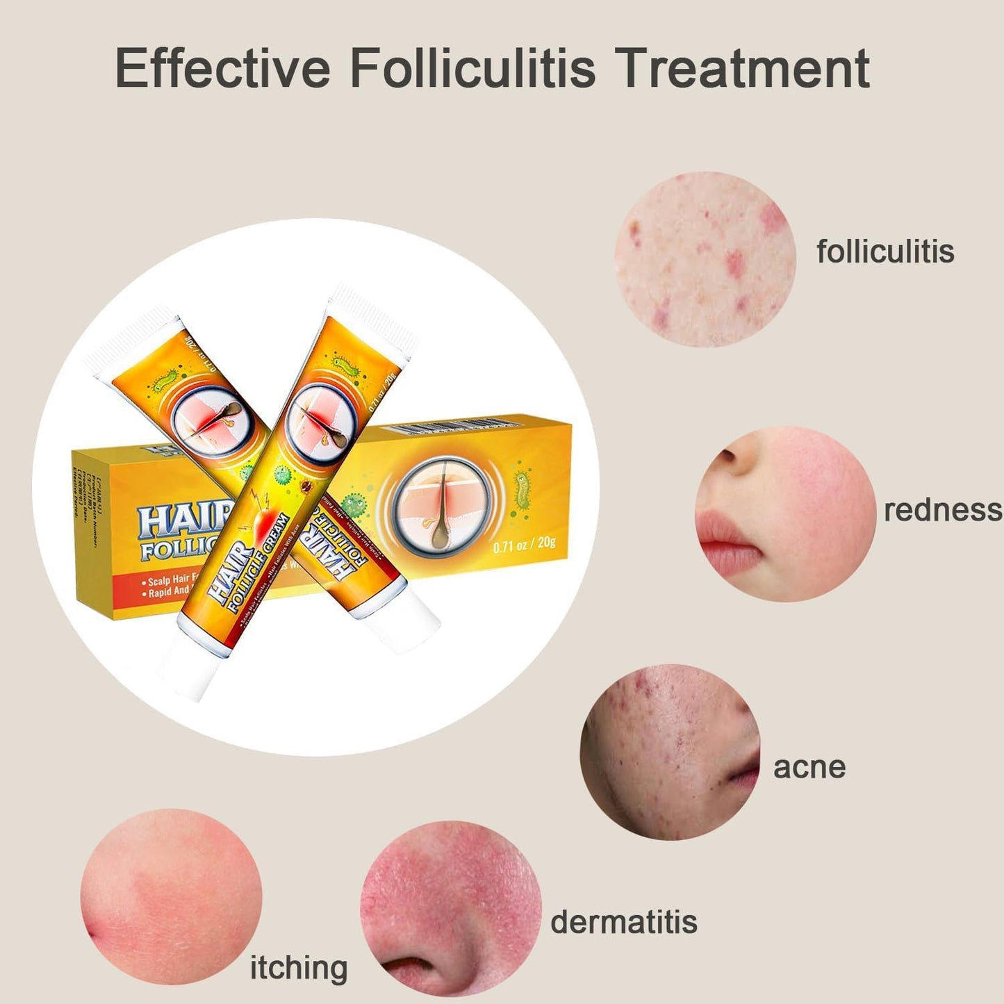 Folliculitis Treatment Cream - Effective Relief for Scalp, Face & Body | 1.42 Oz