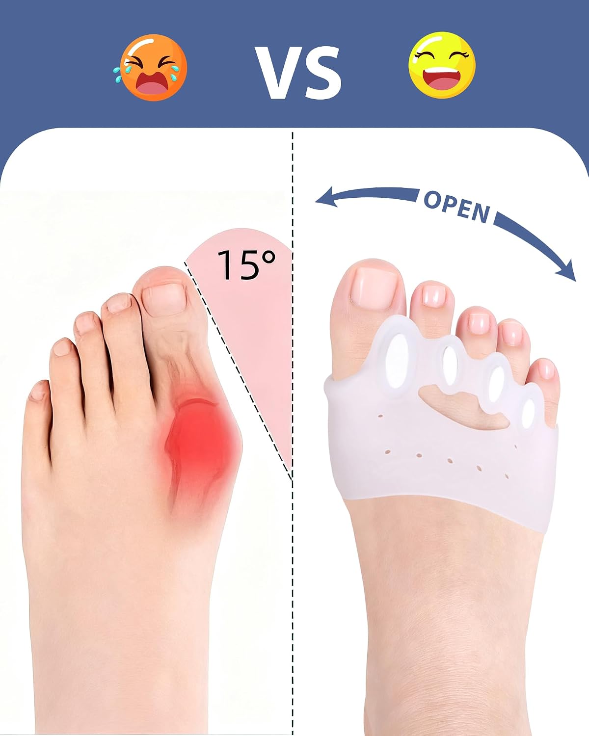 Silicone Toe Separators - Bunion Corrector & Toe Straightener | Soft, Breathable Cushions (4 Pairs)