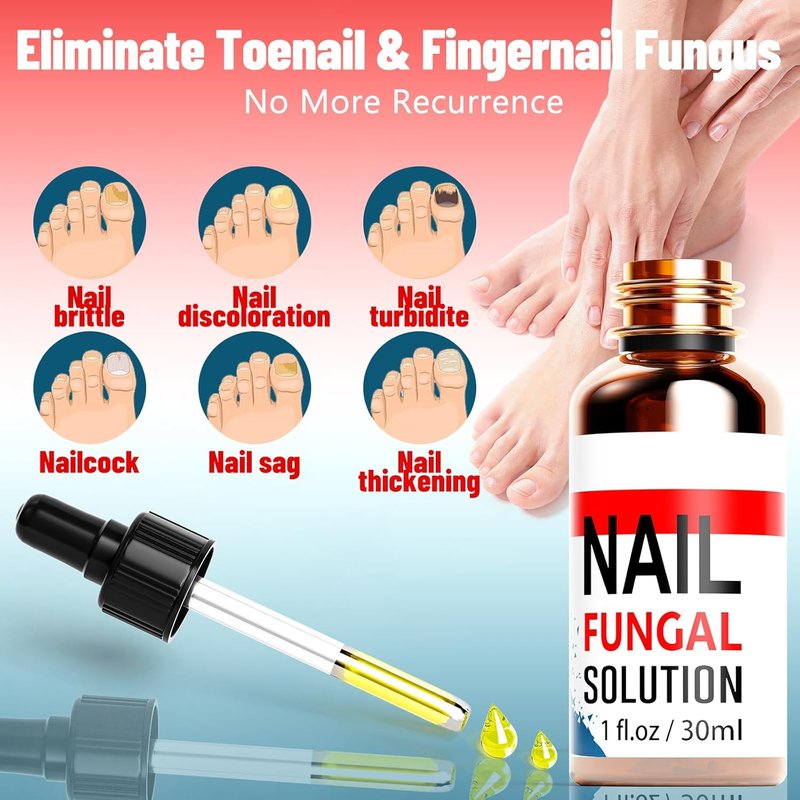 Toenail Fungus Treatment - Extra Strength 25% Undecylenic Acid | Gentle Plant-Based Formula, 1.01 Fl. Oz (Blue)