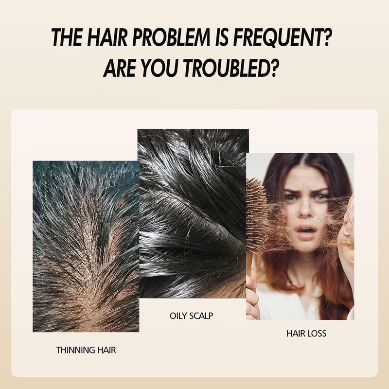 Hair Oil with Rosemary, Onion, and Black Seed - Organic Formula for Hair Growth and Hair Loss Control