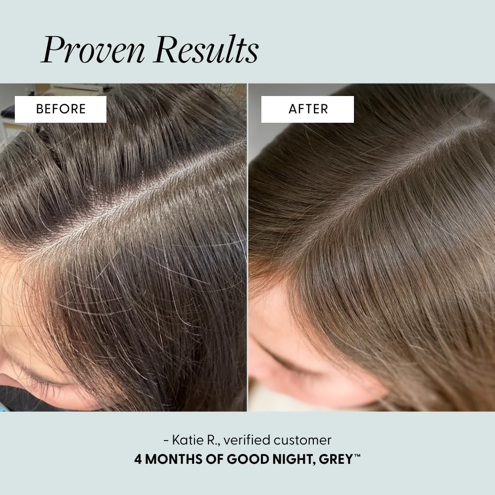 Arey Good Night Overnight Scalp Serum - Boost Hair Density & Reduce Scalp Stress | Lightweight Oil-Free Treatment | 100ml