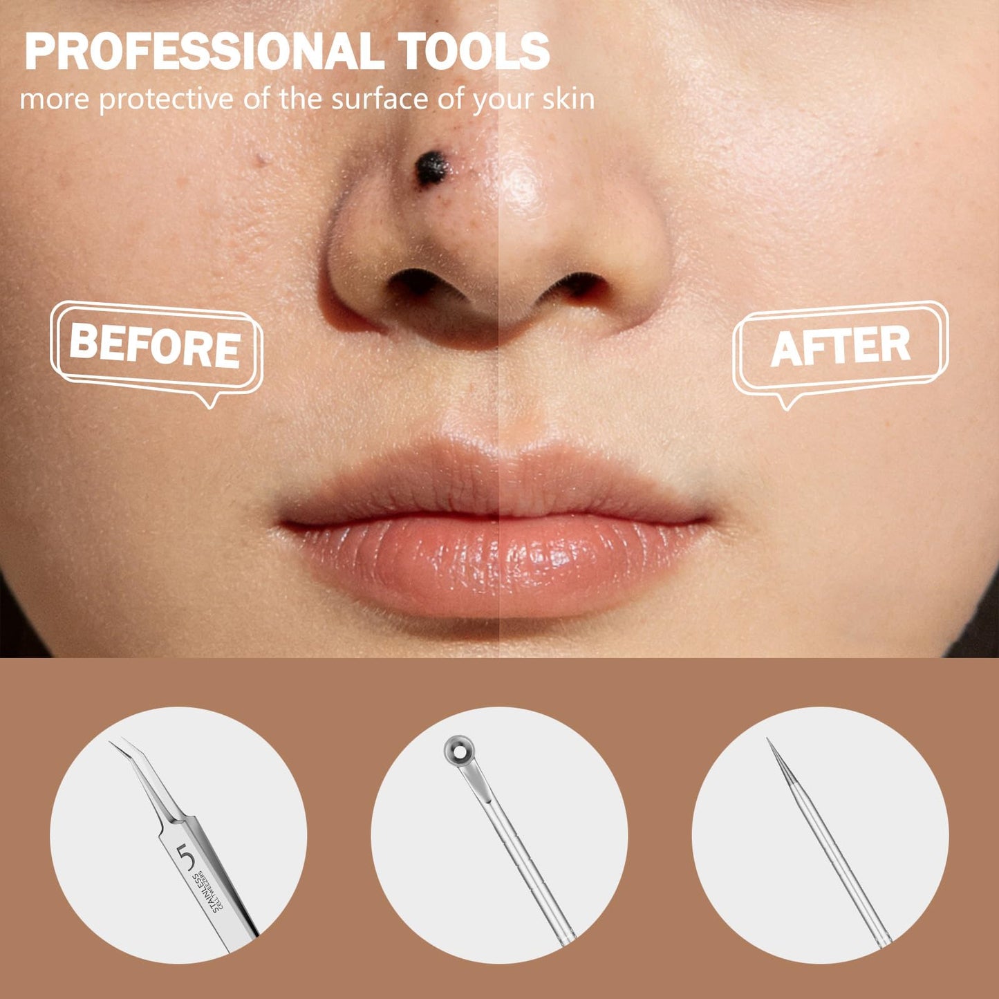 Blackhead Remover Pimple Popper Tool Kit 6 Pcs Blackhead Remover Tools Kit with Storage Case Pimple Popper Tool kit for Face Nose Deep Cleansing Pimple Extractor for Quick and Easy Removal of Pimples