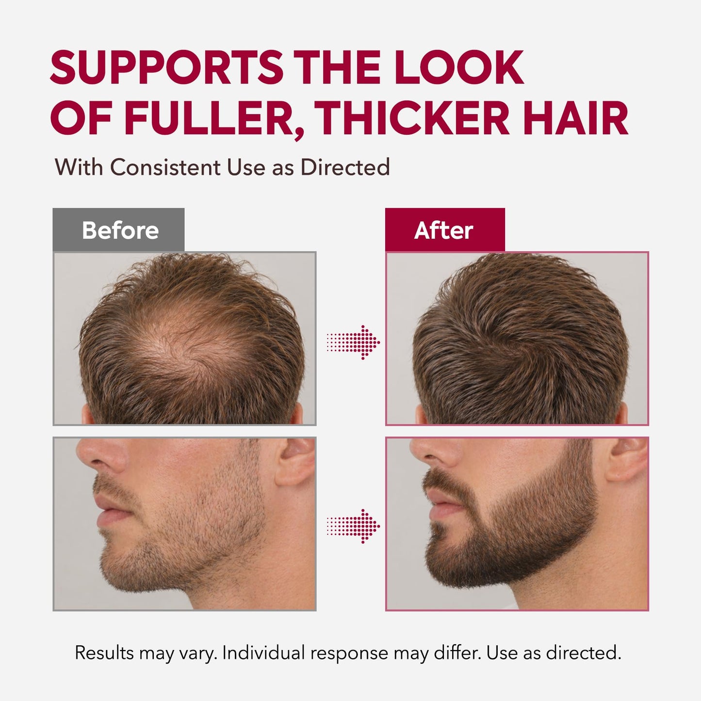 5% Minoxidil Hair Growth Kit for Men and Women: Extra Strength Minoxidil Beard Regrowth Treatment Serum with Biotin for Thinning Hair Loss to Grow Thicker Fuller 60ml