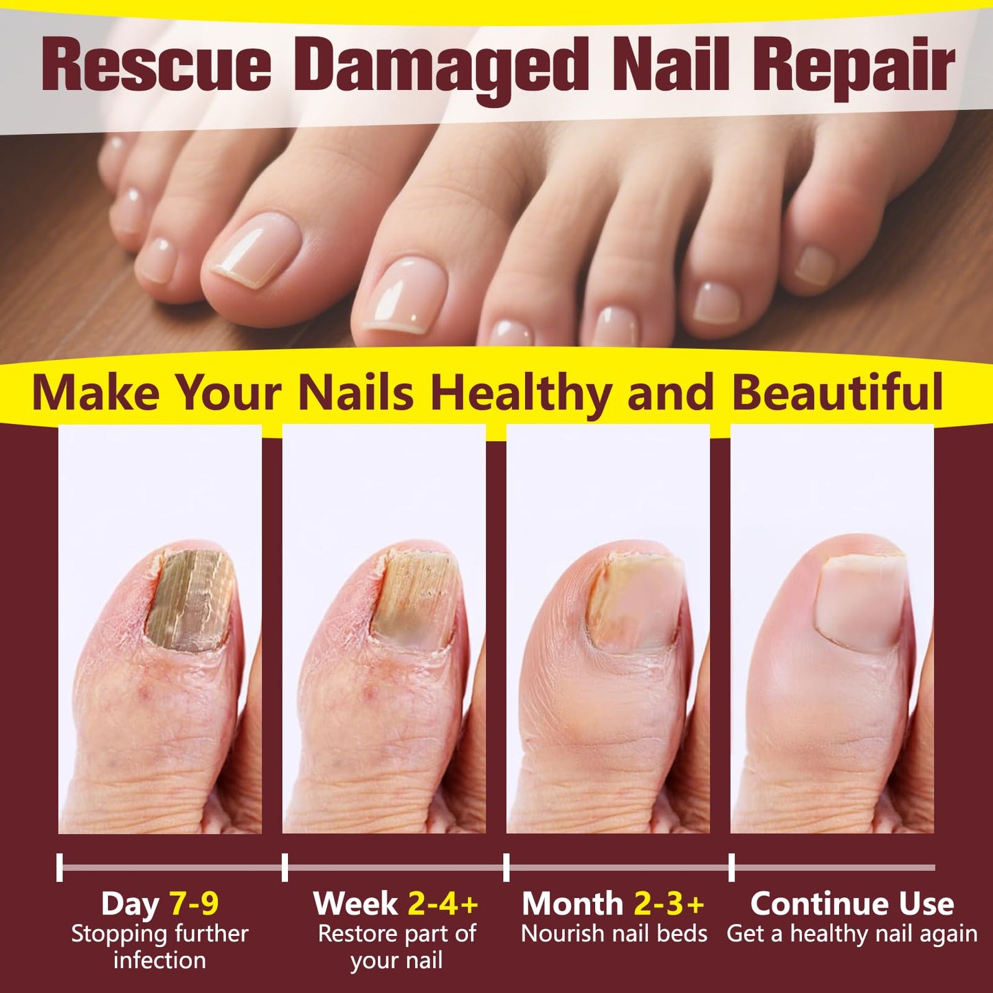 Toenail Fungus Treatment Extra Strength, 25% Undecylenic Acid Nail Repair Liquid for Yellow, Thick Nails, 2 Pcs
