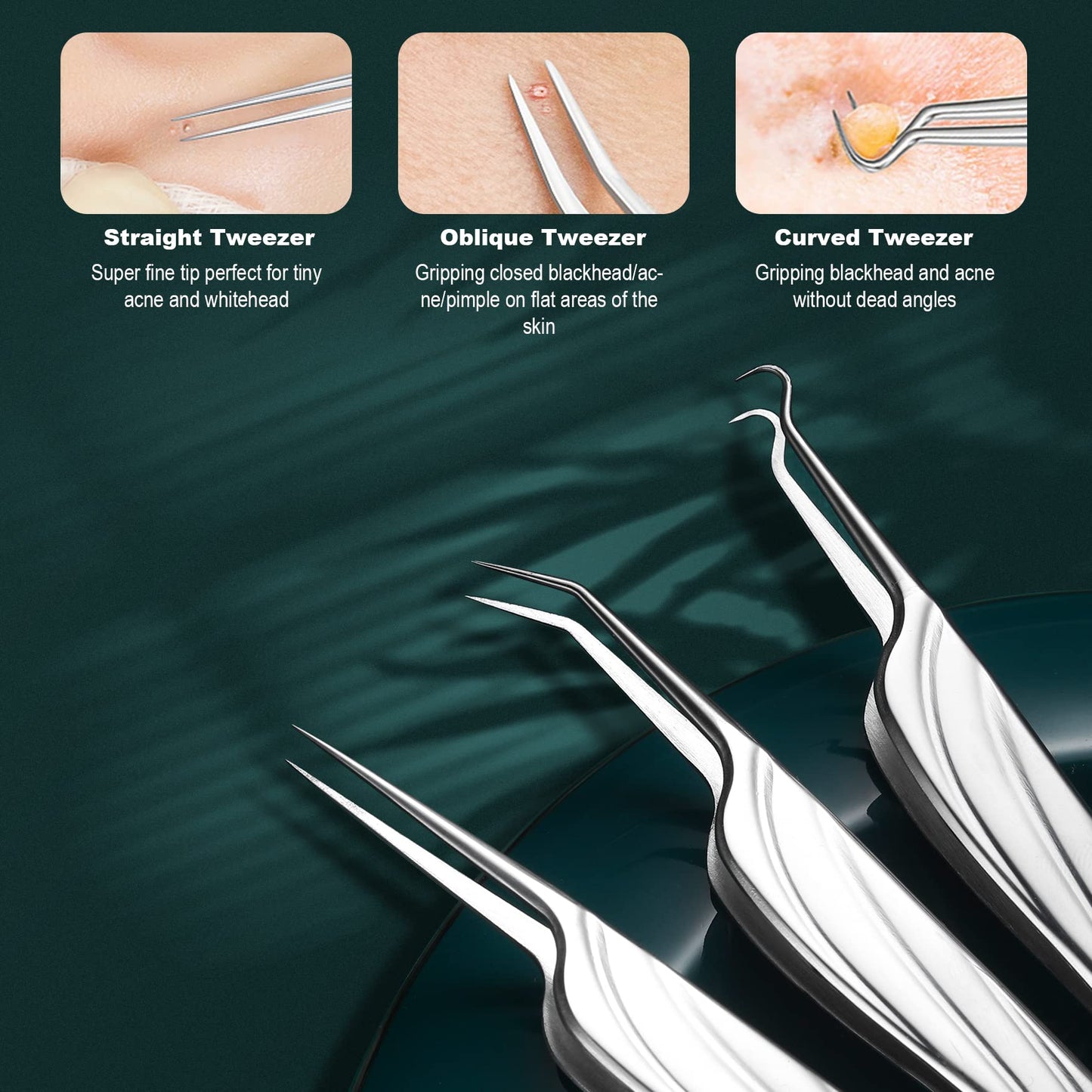 FVION Blackhead and Acne Extractor Kit, Professional Pimple Popper Tool Kit, Acne Tweezers and Blackhead Remover Tools for Face, 6 PCS Surgical Extractor Pimple Popping Tools