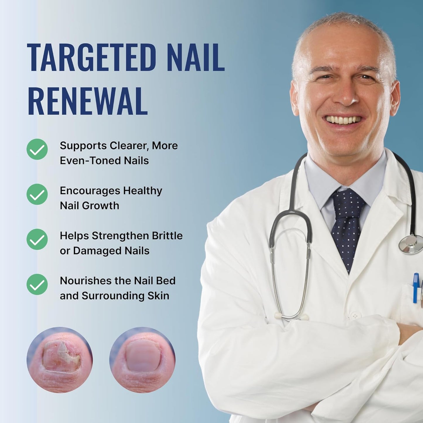Fungix Extra Strength Serum | Undecylenic Acid & Tea Tree Oil for Healthy Nails - Easy Application - 1 Pack