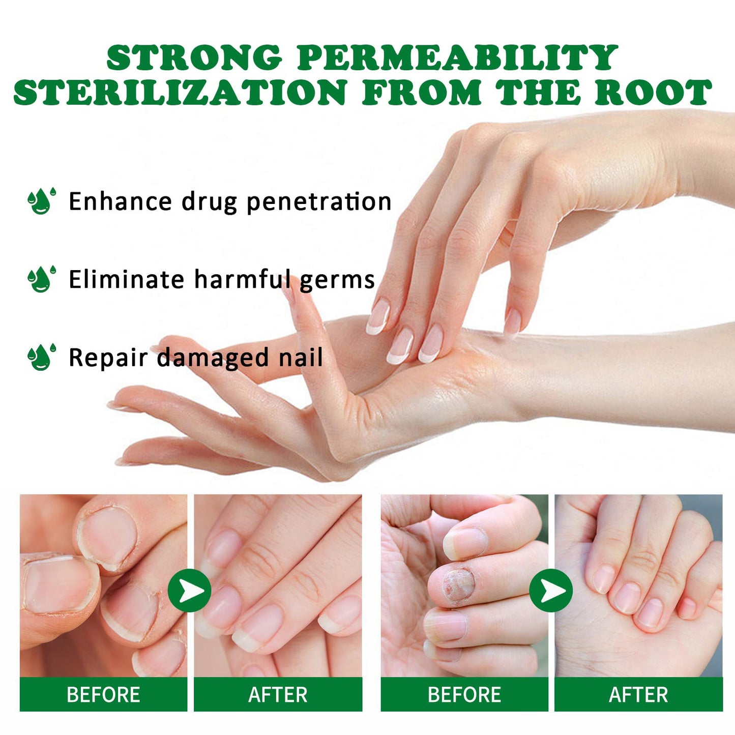 Ginger Nail Growth Serum, Nail Serum 7 Days Intense Repair for Nails Edges, 30ml