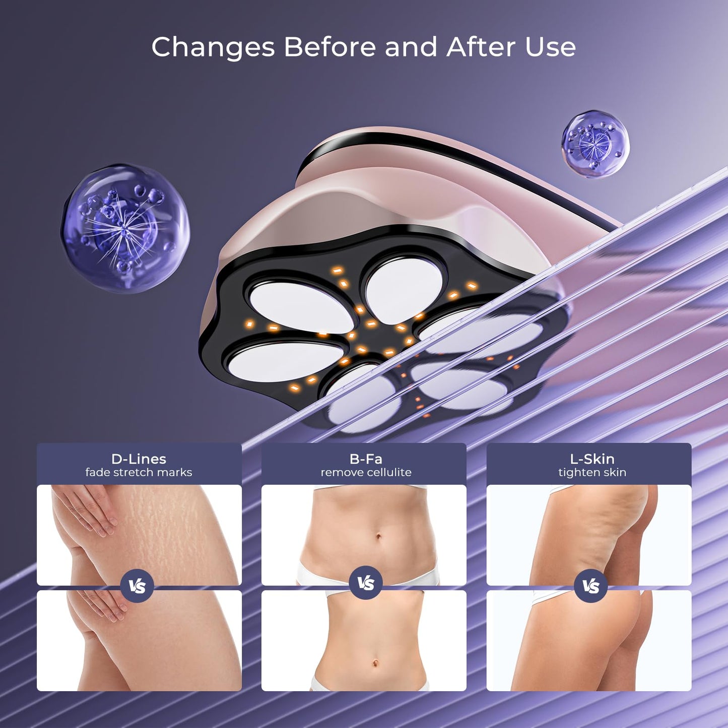 Oranmagic Cellulite Massager Tool, 4 in 1 Body Sculpting Machine, Upgraded 6 Electrode Body Skin Tightening Device Cellulite Remover for Legs, Belly, Waist, Arms, Buttock, Wireless & Lightweight