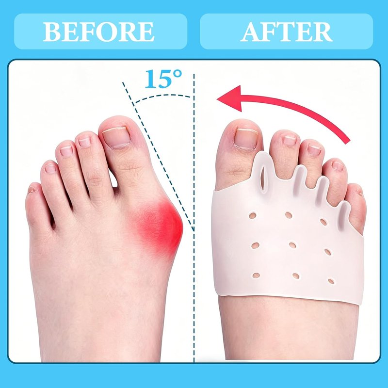 Toe Separators for Bunion Relief - Breathable Toe Spacers for Men & Women | 8 PCS in 4 Colors