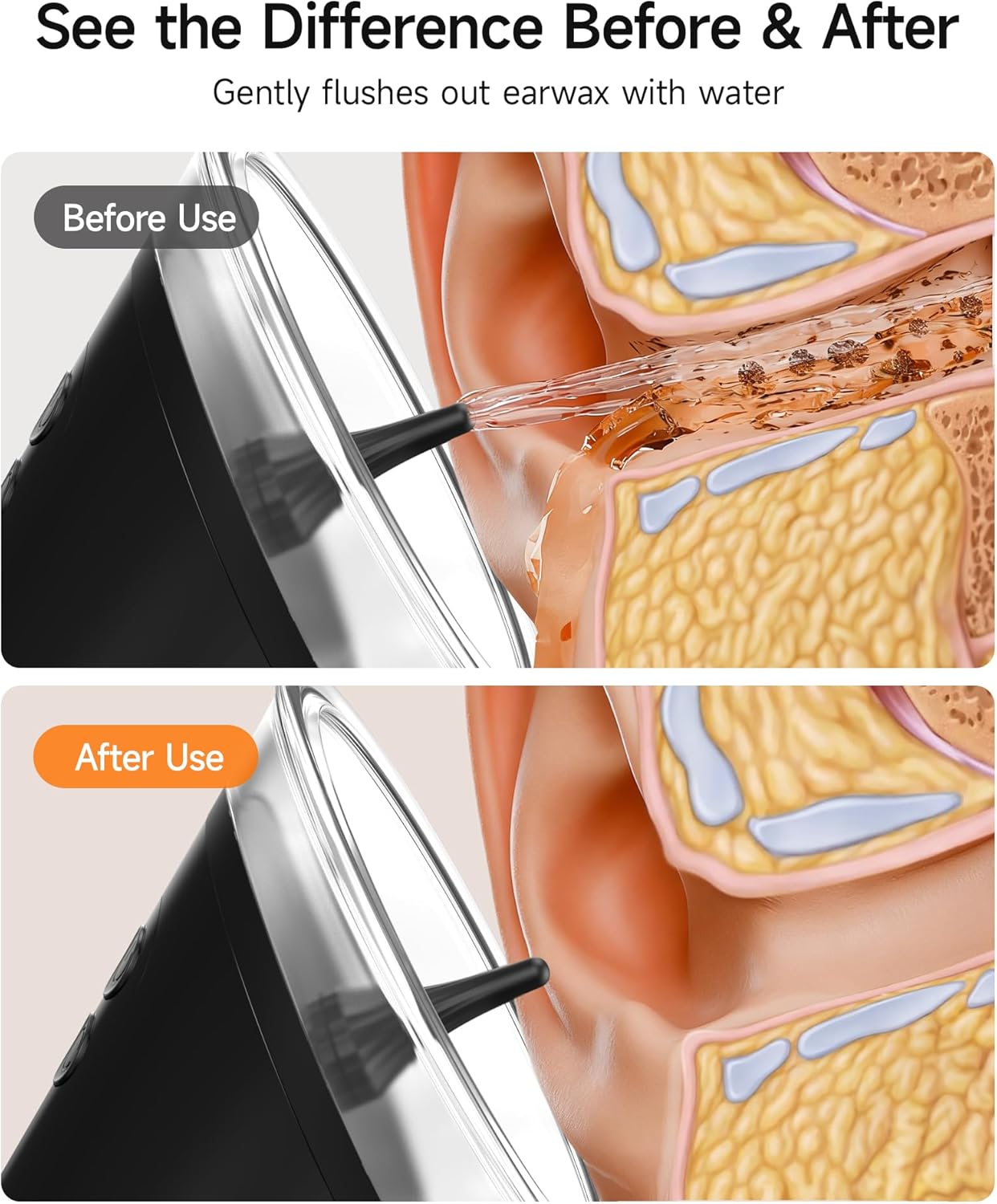 Electric Ear Wax Removal Kit - LED Display, Dual Clean System | 3 Modes, 12 Nozzles, IP67 Waterproof