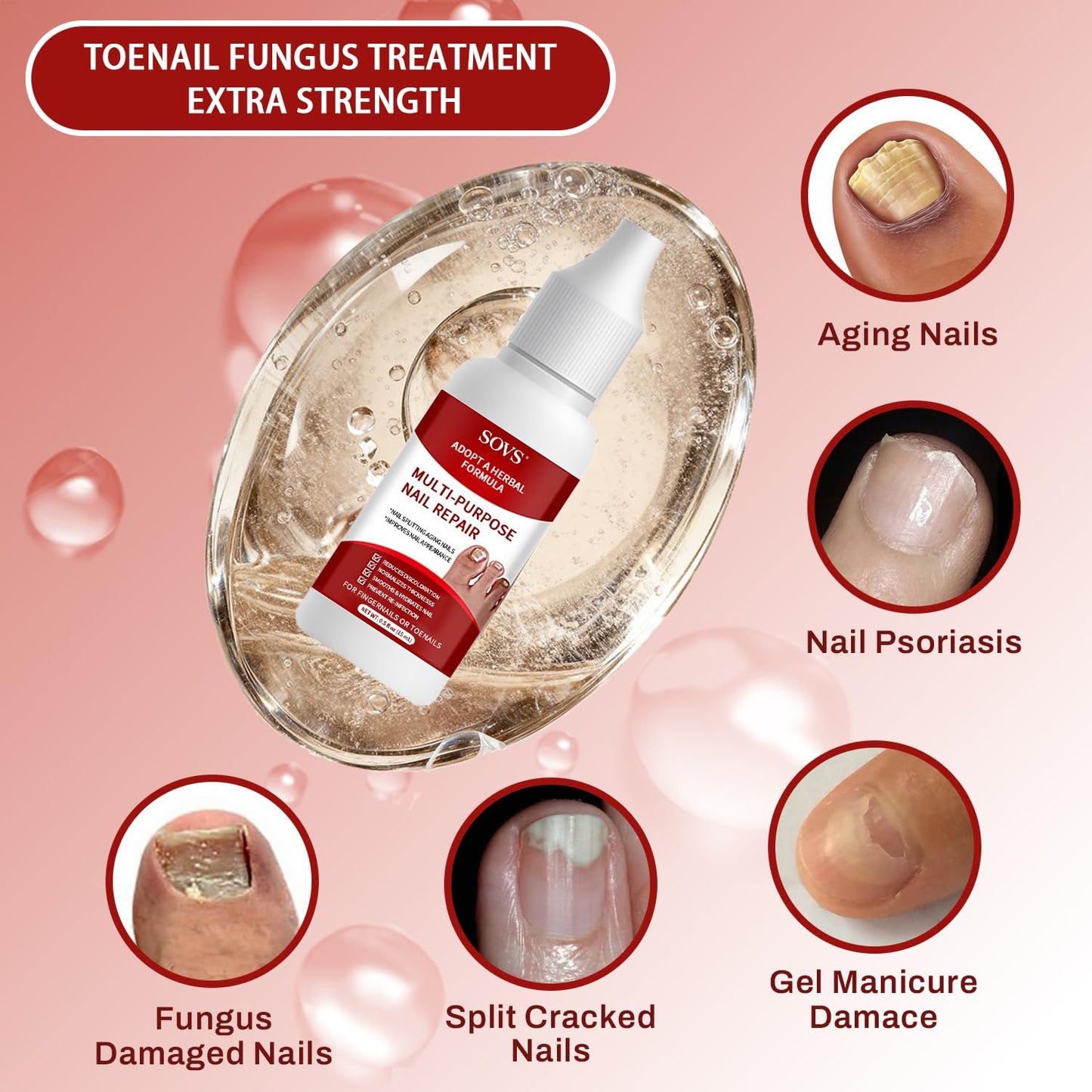 Fungi Nail Toenail Treatment - Gentle Formula for Healthy Nails | 1 Piece