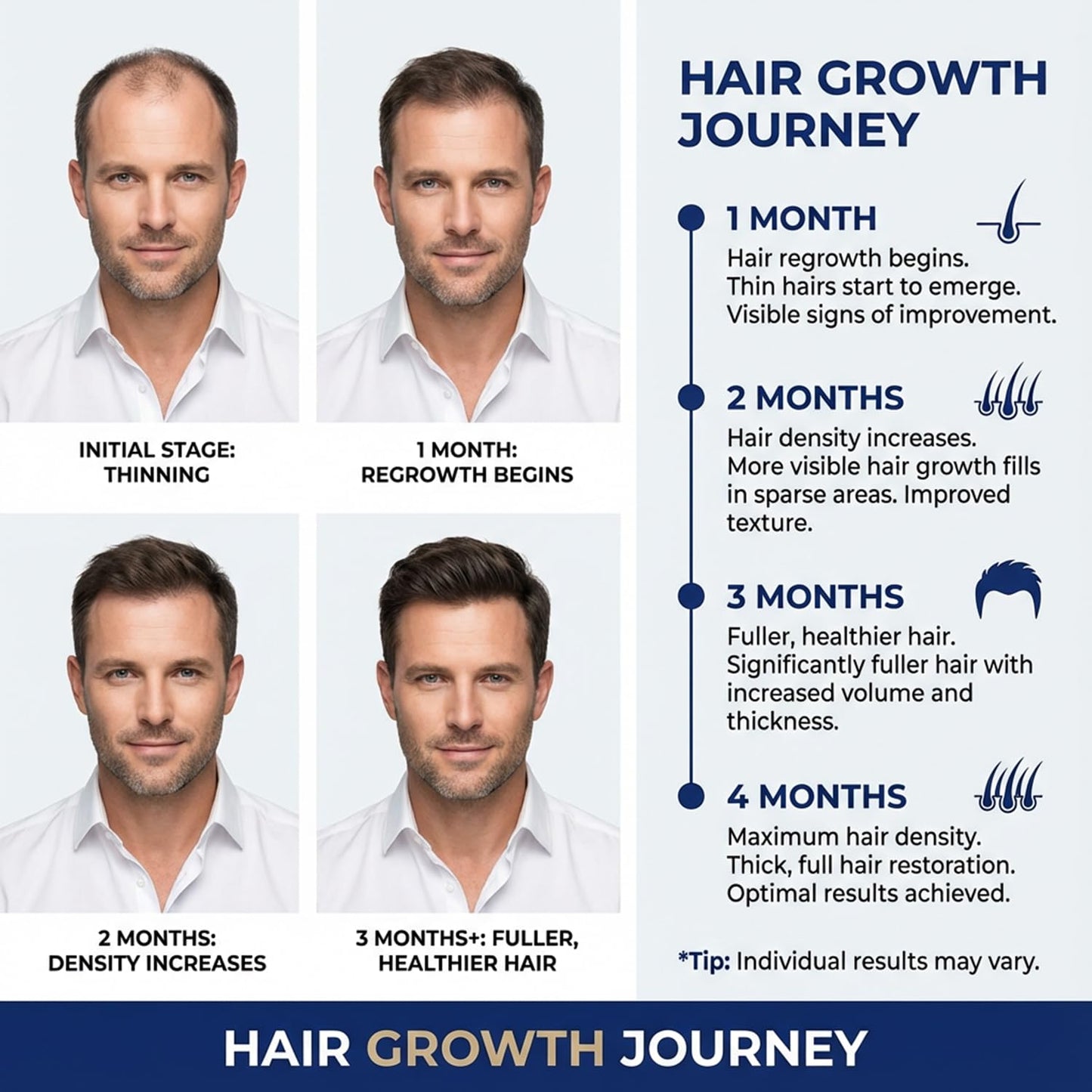 Nigwedete Minoxidil 5% for Men (120 ML), Advanced Minoxidil Spray with Provitamin B5 and Castor Seed Extract, Minoxidil Extract Serum for Hair Loss, Beard Restoration