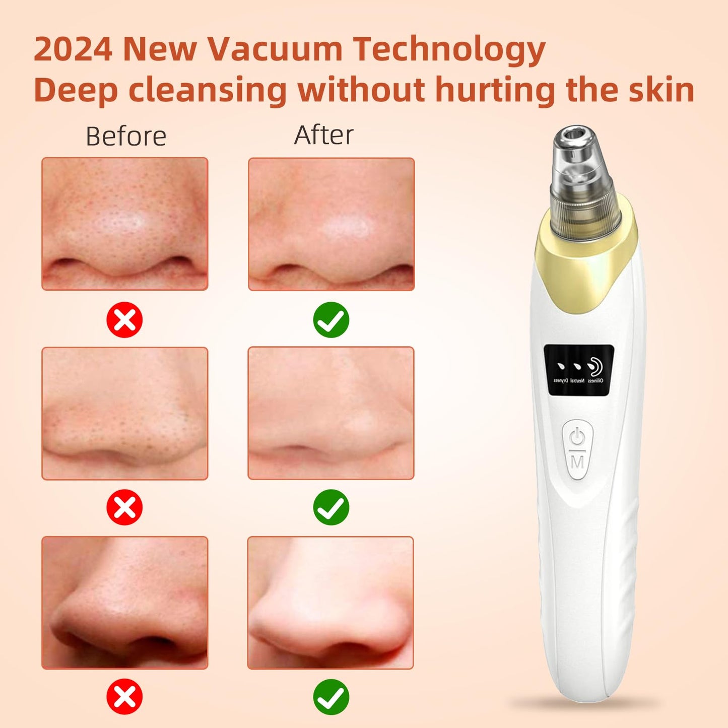 Pore Vacuum, USB Rechargeable Blackhead Remover Vacuum,3 Levels Adjustable Pore Vacuum Blackhead Remover, with 4 Suction Power,5 Probes,Face Vacuum Pore Cleanser for Women & Men-Light Purple