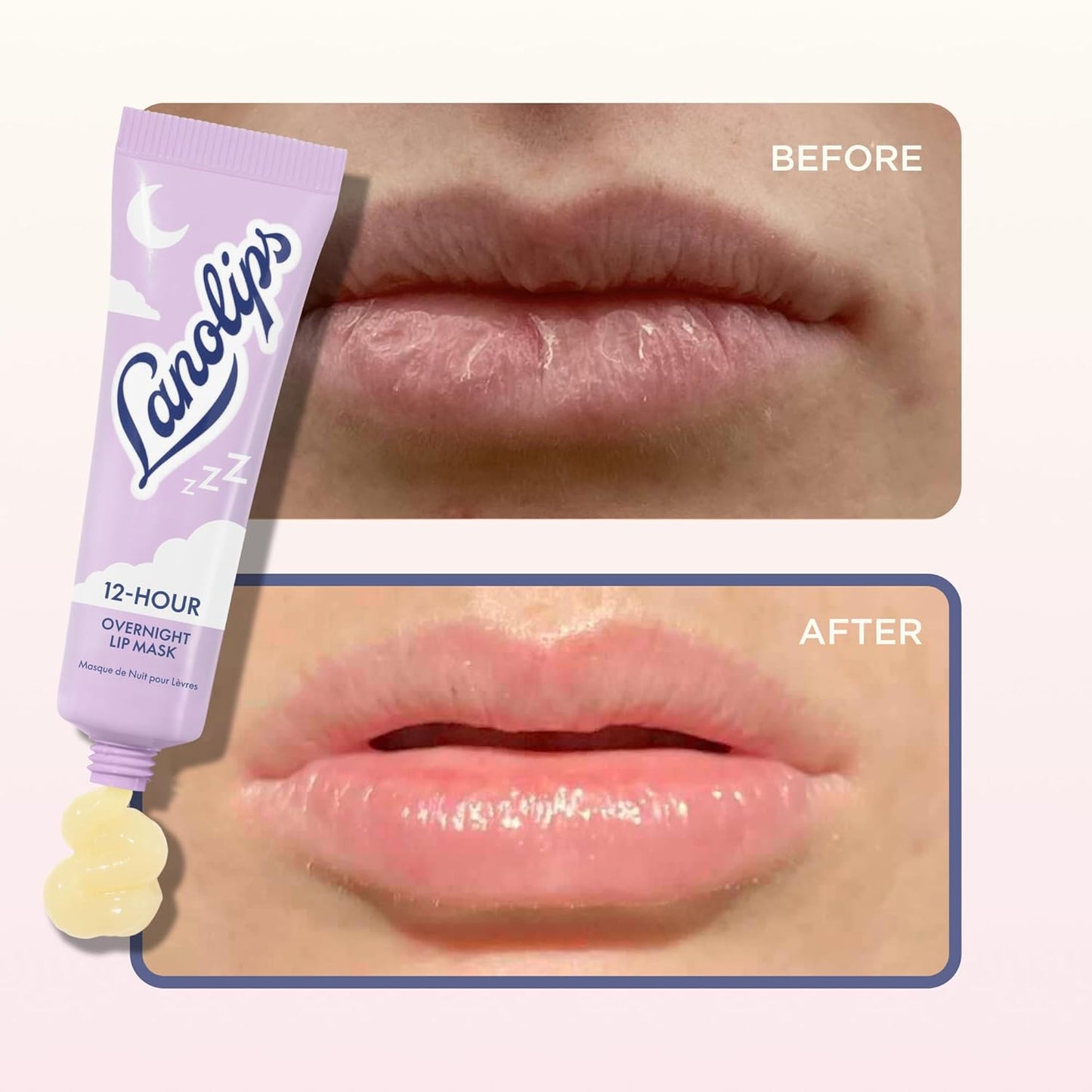 Lanolips Overnight Lip Mask & Golden Dry Skin Salve Duo | Deep Hydration & Repair - 0.52 oz & 25 g