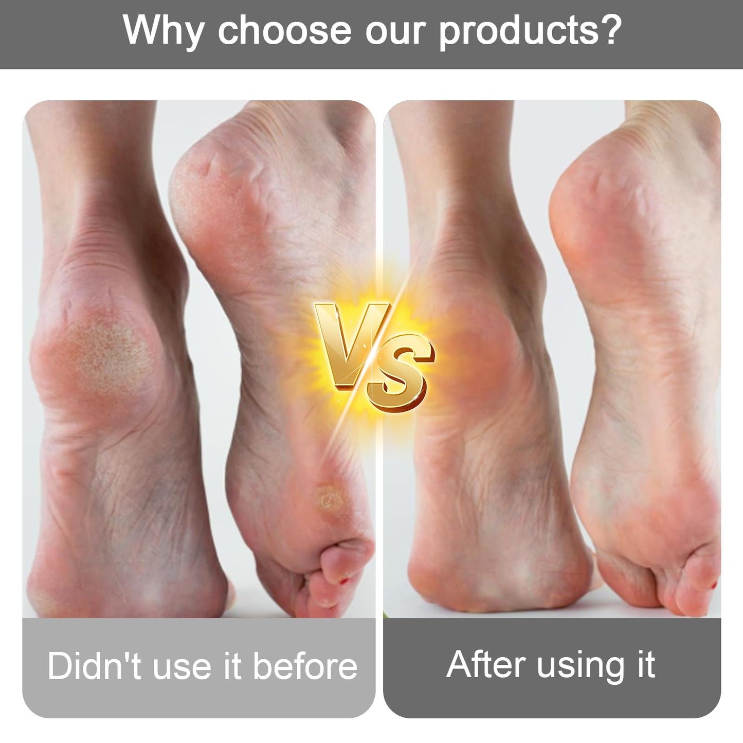 Pumice Stone Foot Exfoliator Callus Remover Pedicure Tool for Women Men Wife Husband Shower or Bath Foot Care 1 Pcs(Grey)