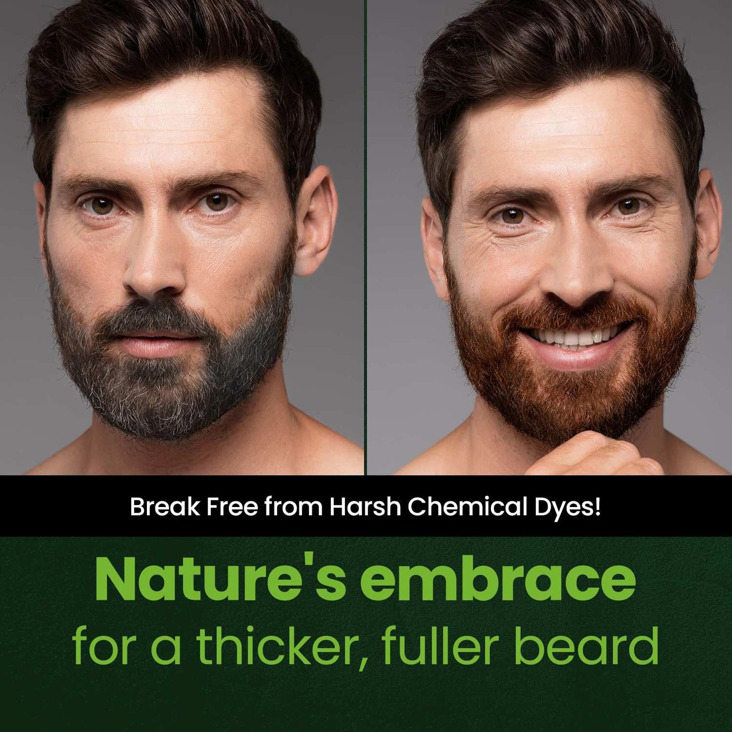 Mustache & Beard Dye for Men - Dark Brown, PPD-Free & Ammonia-Free, Vegan Formula for Sensitive Skin | 1 Pack