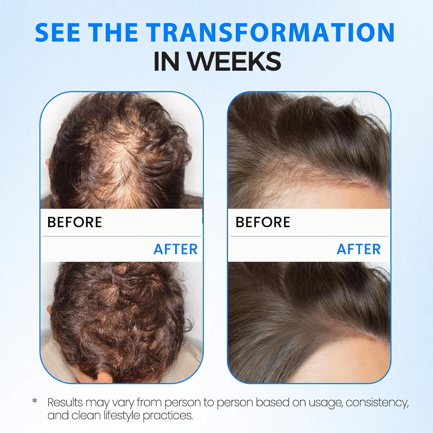 Hair Growth Spray - Thicker Longer Hair with Batana Oil & Thuja Extract | Non-Greasy Scalp Serum, 2 fl oz
