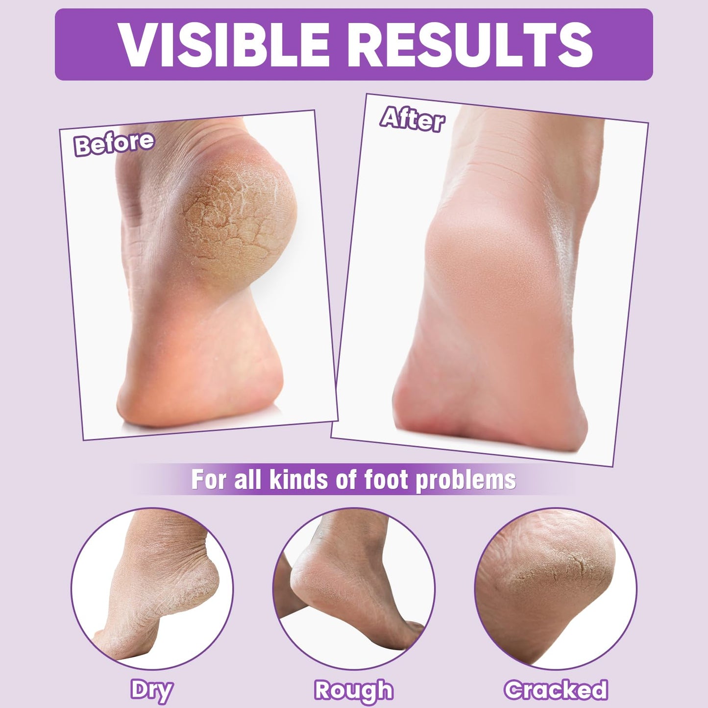 TEAWOO 24 Pairs Moisturizing Foot Masks with Lavender Oil & Jojoba Oil, Intensely Hydrating Foot Mask for Dry Cracked Feet, Moisturizing Socks for Cracked Heel Treatment