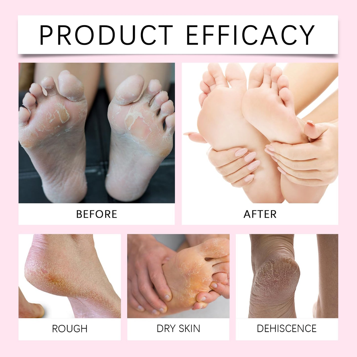 QNJIX Japan Sakur Foot Heel Stick, Deep-Repair Anti-Aging Heel Balm, Foot Callus Cream for Cracks and Dead Skin, Hydrates Rough Heel, Non-Greasy