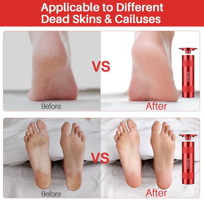 Electric Foot File, Callus Remover for Feet,Adjustable Speed 2 in 1 Electric Foot File Nail Grinder with 60 Pcs Sandpaper Discs, Tool for Dead Skin and Calluses,Gift for Women, Men- Red
