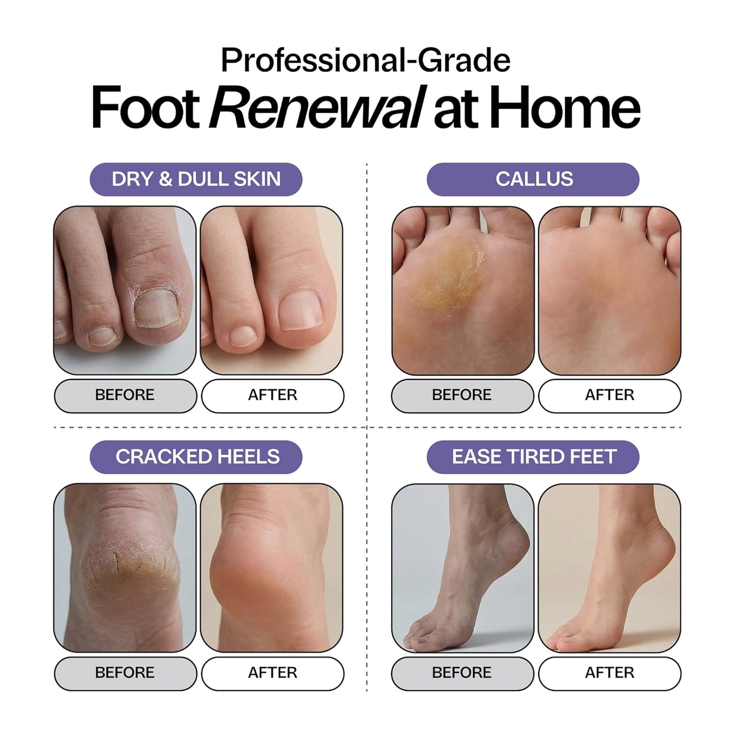 Lavender Foot Soak - Epsom Salt Relaxation & Aromatherapy | Soothes Tired Feet & Softens Skin - 1lb Made in USA