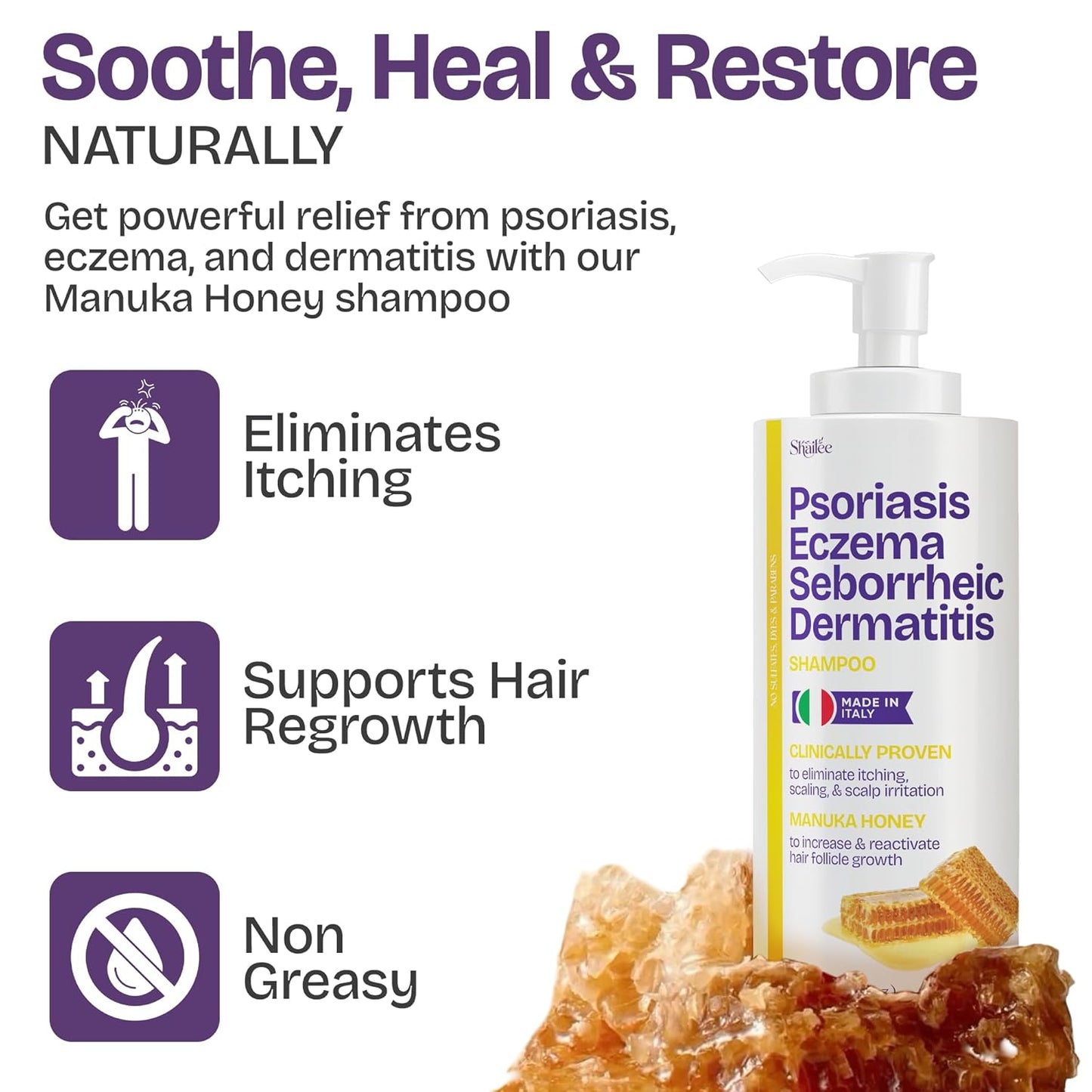 Psoriasis Shampoo - Antifungal Treatment for Eczema, Folliculitis & Seborrheic Dermatitis | Manuka Honey Formula