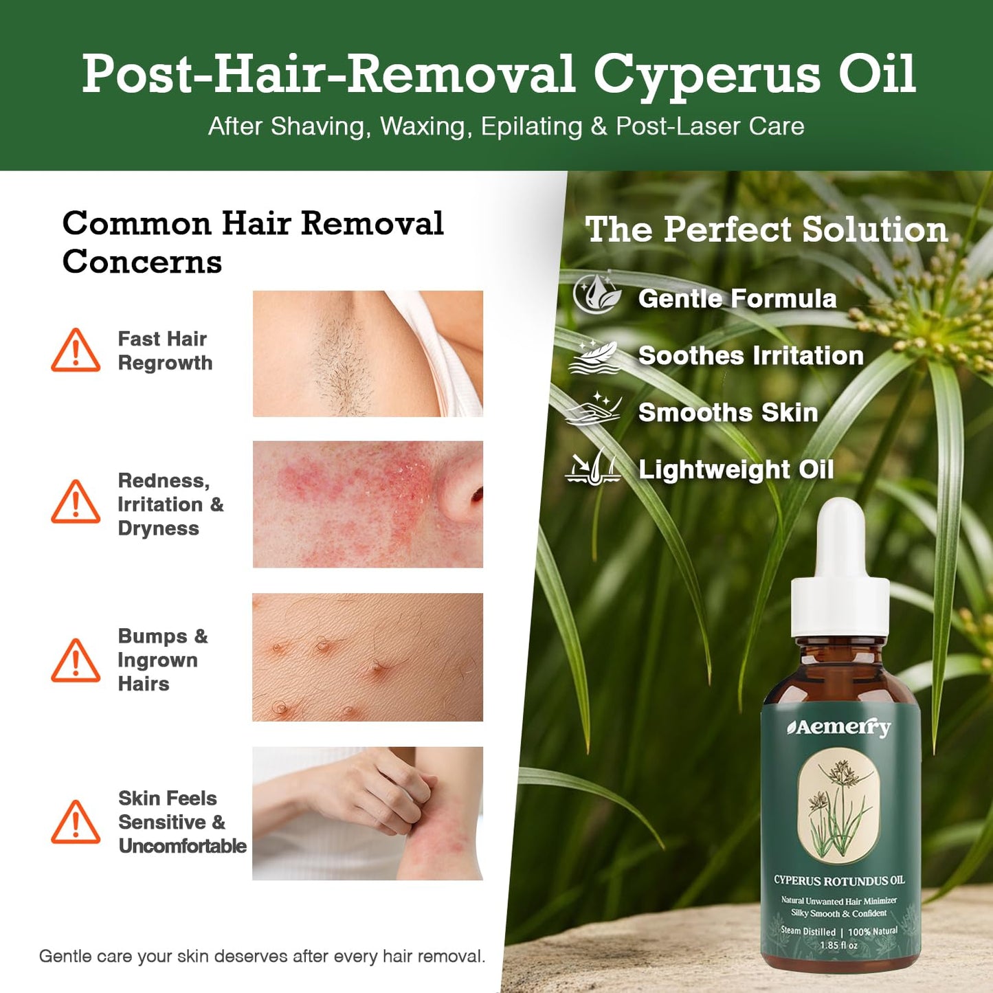 Cyperus Rotundus Oil for Hair Removal - Natural Soothing Formula | Hydrates & Smooths Skin, 55 ml