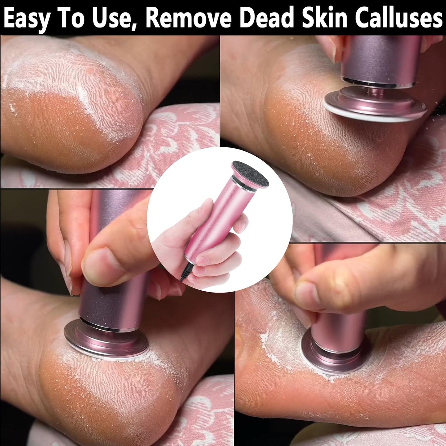 Electric Foot File Callus Remover - Adjustable Speed Pedicure Tool for Dead Skin & Calluses | Upgraded FCR-1 Pink