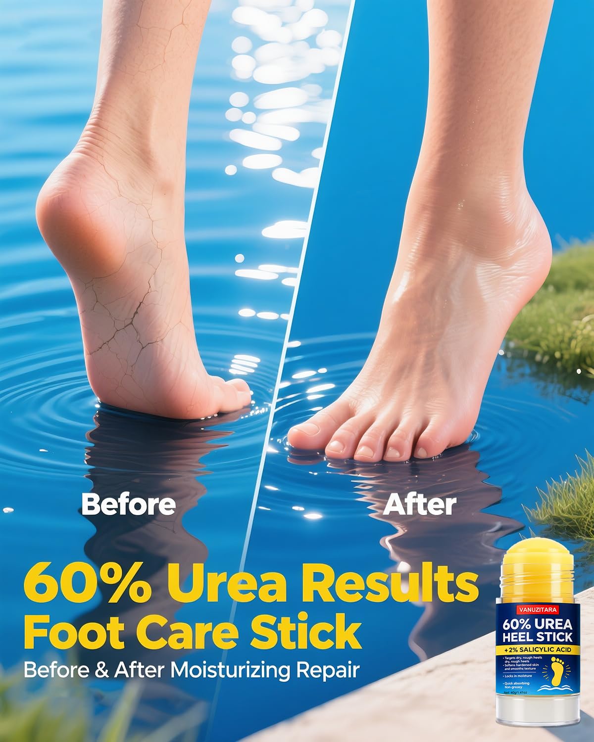 Urea Cream 60% with 2% Salicylic Acid - Maximum Strength Foot & Hand Cream for Dry, Cracked Skin | 1.41oz