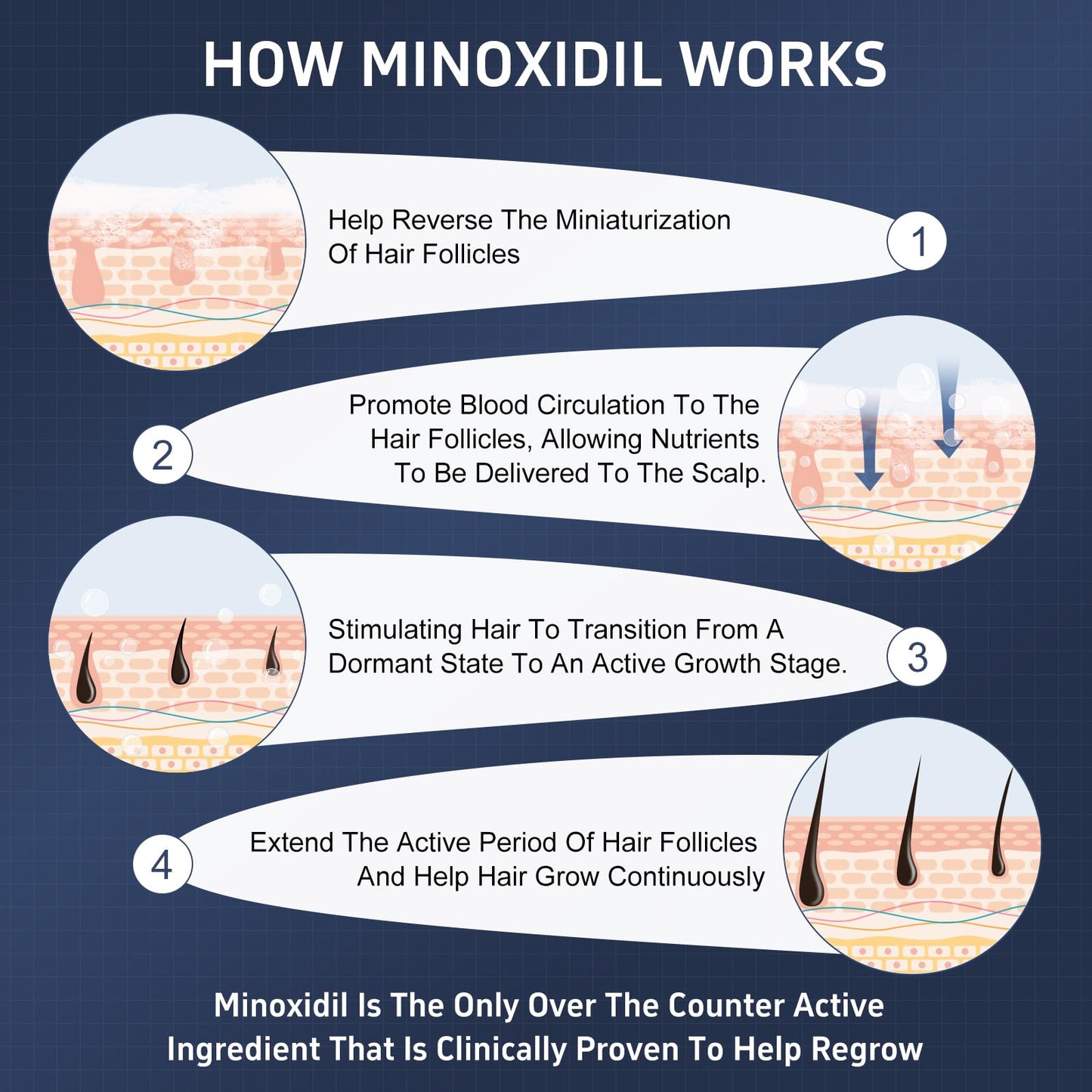4 Packs Minoxidil Foam, 5% Minoxidil for Men and Women, Infused with Biotin, Hair Growth Treatment, Supports Thicker and Fuller Hair & Beard, Upgraded version (Minoxidil Foam 8.44Oz, 4-Month Supply)