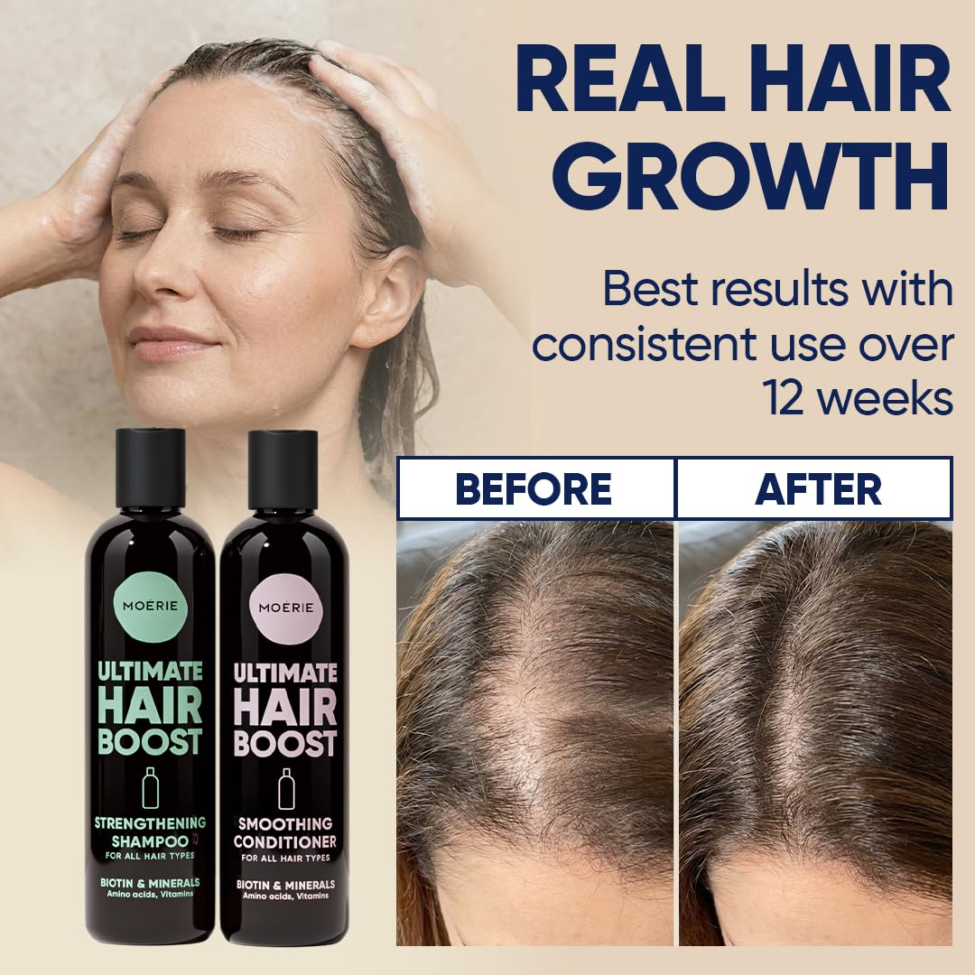 Moerie Hair Growth Shampoo and Conditioner for Women and Men, Hair Loss Solution with Biotin and Rosemary, Thickening Shampoo and Conditioner for Thinning Hair – Promotes Regrowth, Double Set