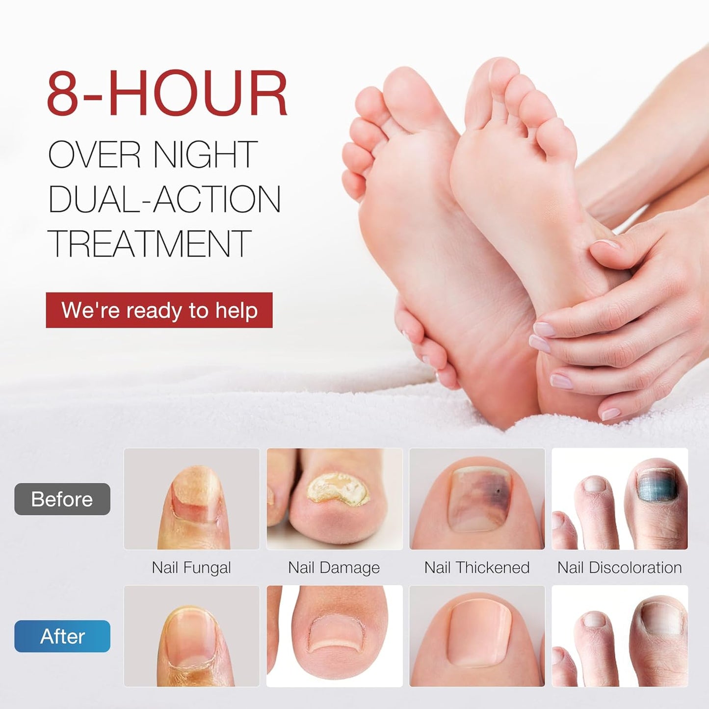 Toenail Fungus Treatment Pen & Fungal Nail Patches Set - Extra Strength Day & Night Care for Damaged Nails
