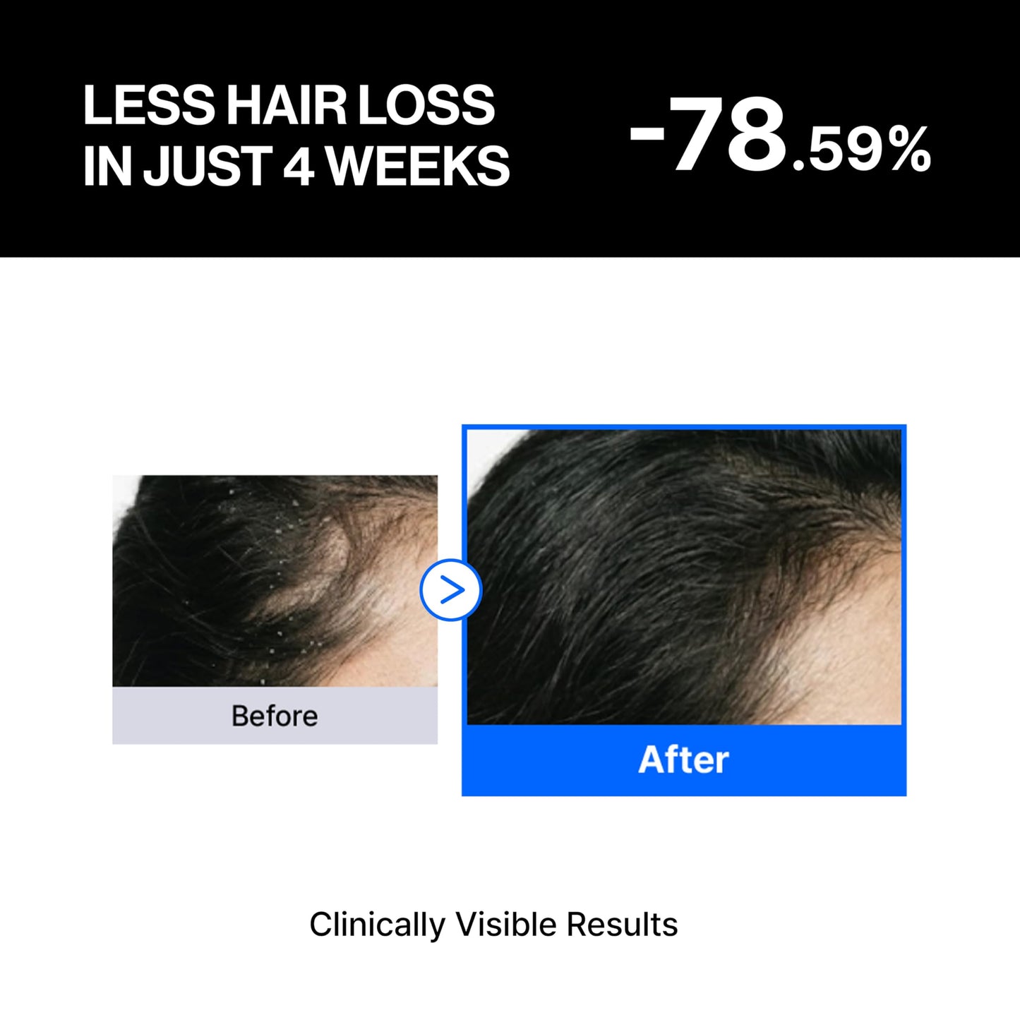 Refilled cADPR Booster Plus Balancing Hair Growth Serum | Lightweight Moisture Scalp Care for Thin & Weak Hair | Non-Greasy Care with Built-In Scalp Massager | Cytokine, Biotin for Dry Scalp
