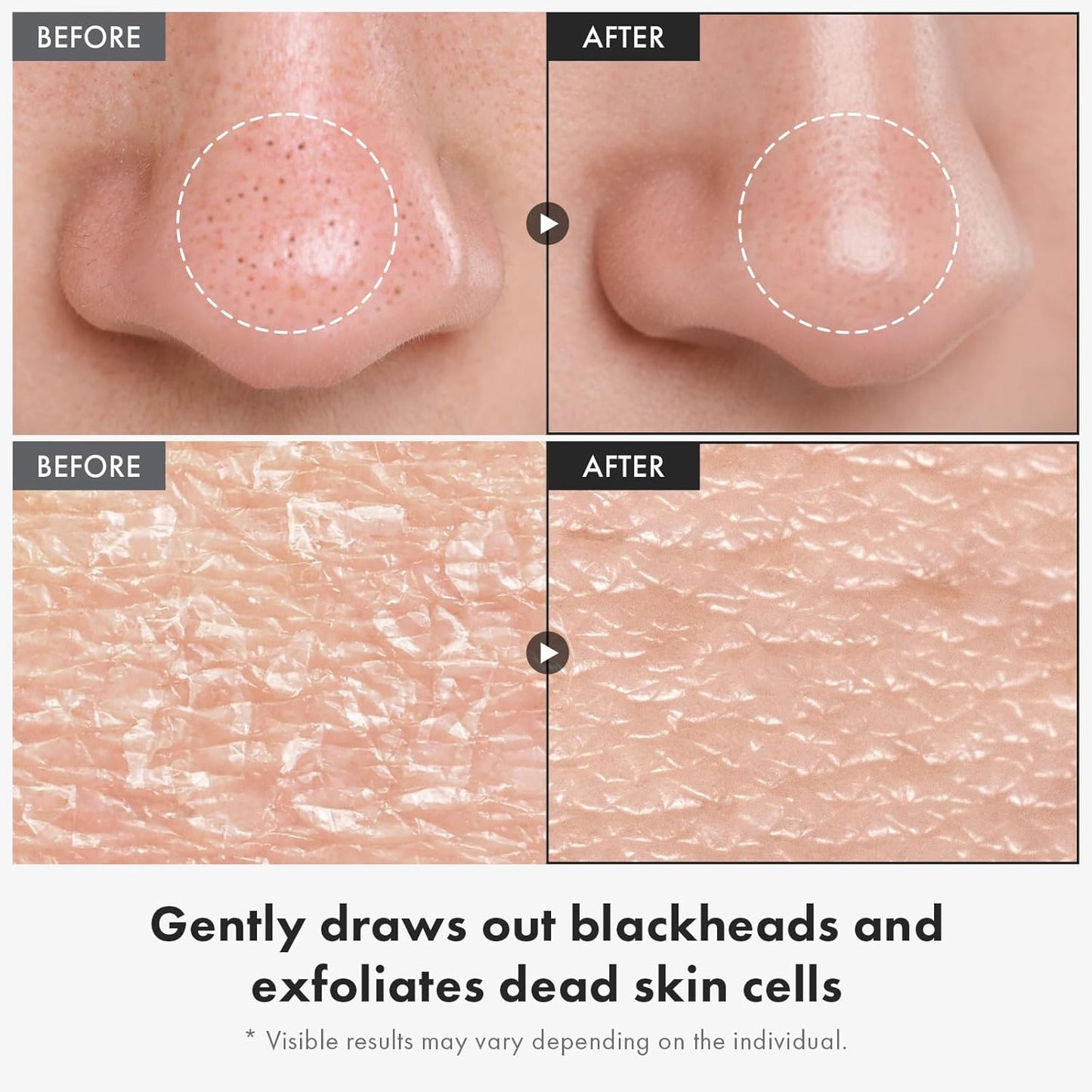 Black Rice Peeling Ampoule - 75% Exfoliant for Dead Skin & Blackheads | Korean Skincare, 85ml