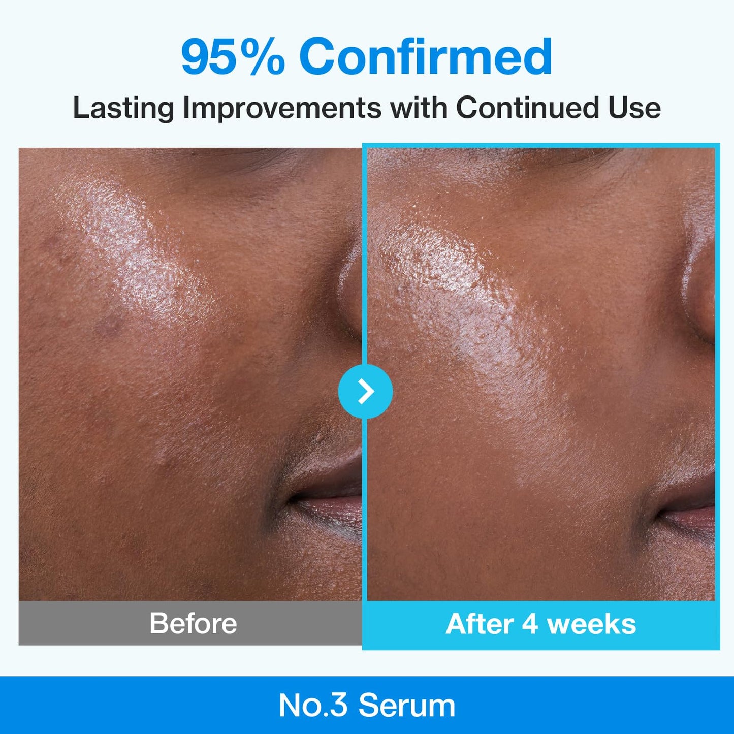 Numbuzin No.3 Retinol Serum - Blue Bio-Retinol Pore Refining | Tightening, Firming, BHA, Niacinamide, Peptide | 1.01 fl. oz (30ml)