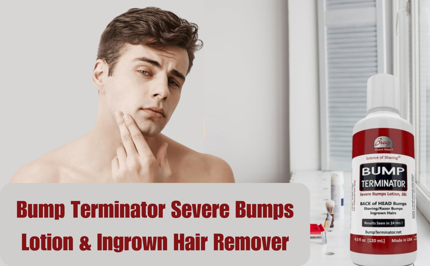 BUMP TERMINATOR Severe Bumps Treatment | Razor Bumps And Ingrown Hair Treatment | Bikini Bumps | Back of Head Bumps And Ingrown Hair Treatment, 4 oz. (Pack of 1)