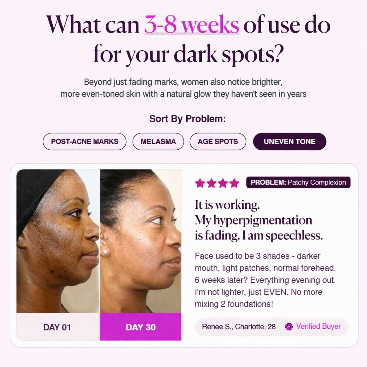Brightening Cream - Arbutin & Tranexamic Acid for Uneven Skin Tone | Daily Skincare Routine (1.7 oz)