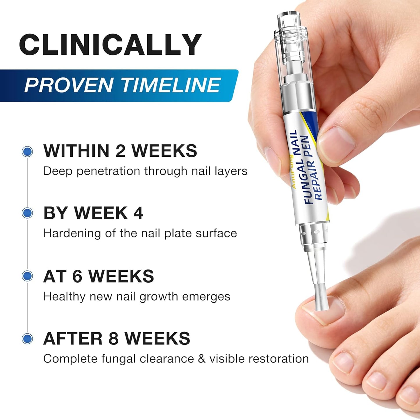 Toenail Fungus Treatment - Extra Strength Anti-Fungal Pen | 25% Undecylenic Acid for Damaged & Discolored Nails - 3-Pack