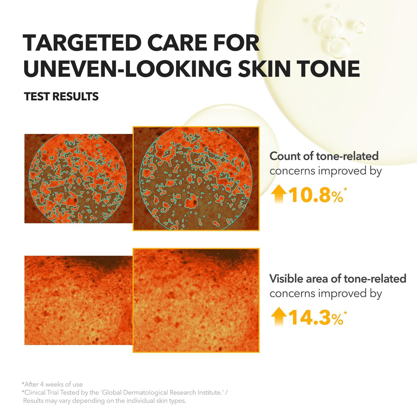 APRILSKIN A.C.E Serum - Vita Kojic Brightening Serum with Kojic Acid & Vitamin C | 3.88 oz for Even Skin Tone