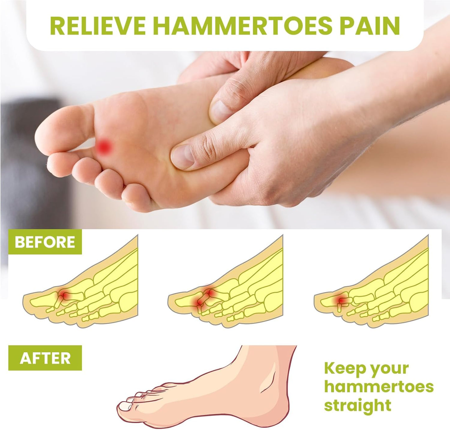 Hammertoe Corrector Gel Toe Straighteners - 12 Pcs for Men & Women | Realign Bent, Crooked, Claw Toes - Clear, Multi-Size