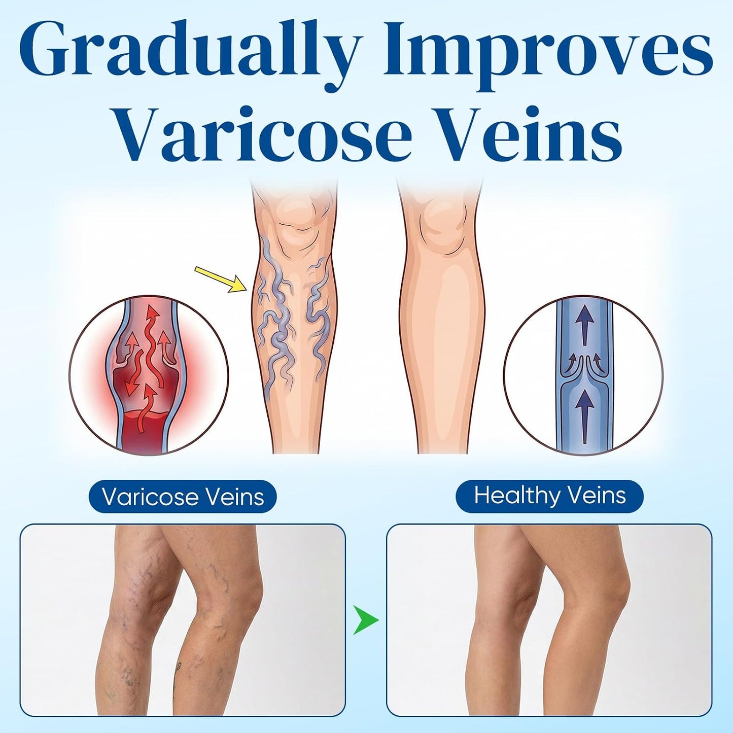 Vein Target Microdarts Patch - Professional Varicose Veins Treatment for Legs | Improves Blood Circulation, Natural Ingredients